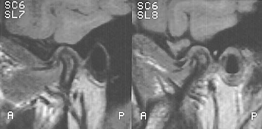 image15.jpg (23289 bytes)