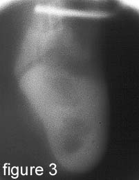 radiologi9809-3-3.jpg (10523 bytes)