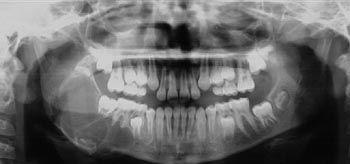 digital panoramic image